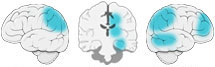 Fonction Cognitive Exercée