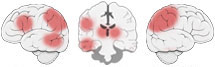 Fonction Cognitive Exercée