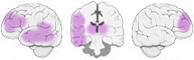 Fonction Cognitive Exercée