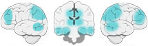 Fonction Cognitive Exercée