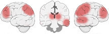 Fonction Cognitive Exercée