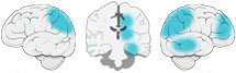 Fonction Cognitive Exercée
