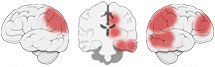Fonction Cognitive Exercée