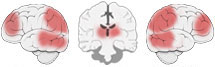 Fonction Cognitive Exercée
