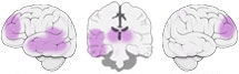 Fonction Cognitive Exercée