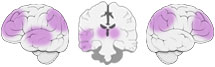 Fonction Cognitive Exercée