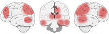 Fonction Cognitive Exercée