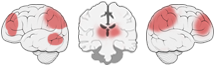 Fonction Cognitive Exercée